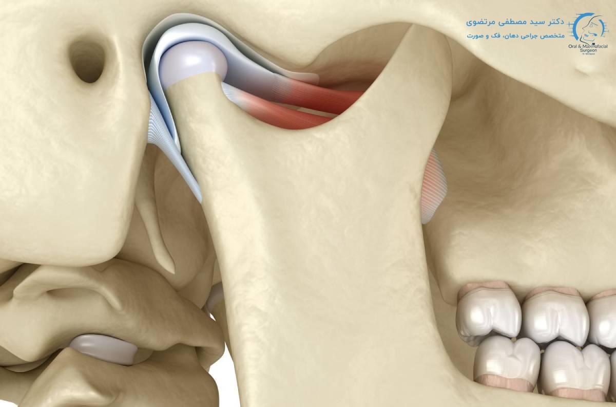 تعیین زمان جوش خوردن فک بعد از جراحی فک به چه عواملی بستگی دارد؟ آیا برای هر فرد یکسان است؟