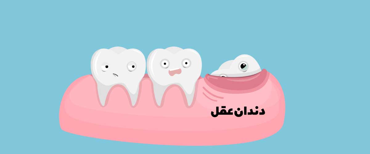 آیا-کشیدن-دندان-عقل-ضروری-است- کلینیک-دکتر-مرتضوی