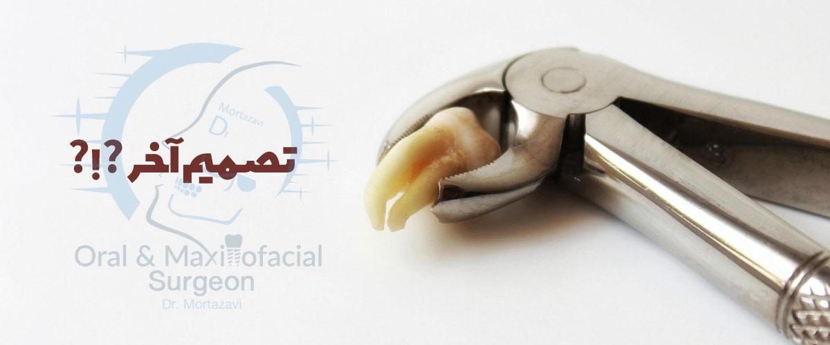 کشیدن-یا-نگه-داشتن-دندان-عقل